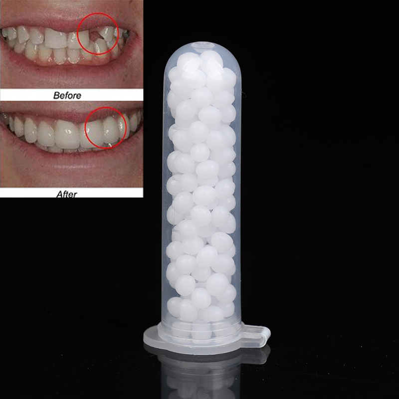 【K】1Box Temporary Tooth Repair - Teeth Whitening Kit recension och pris